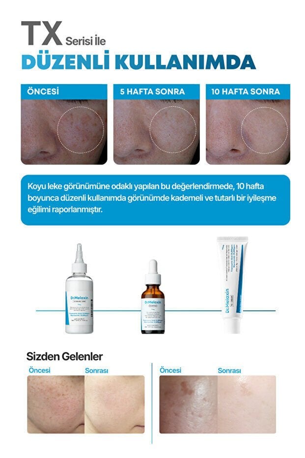 Dr.Melaxin TX Cream Koyu Leke ve Ton Eşitleyici Krem 50ml