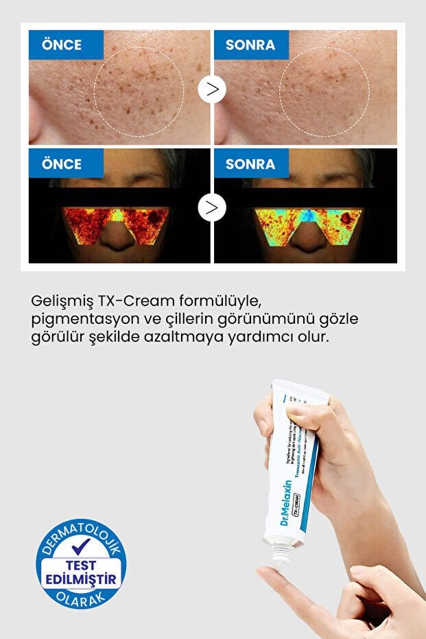 Dr.Melaxin TX Cream Koyu Leke ve Ton Eşitleyici Krem 50ml